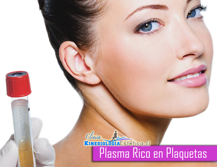 Plasma Rico en Plaquetas 