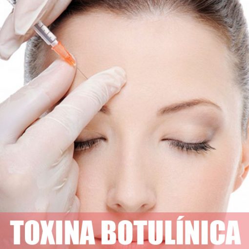 3 zonas de toxina botulínica