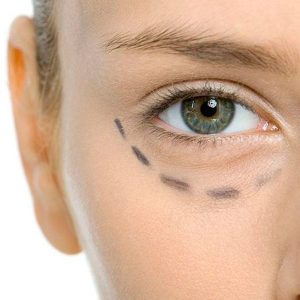 Reductivo Ojeras PBserum