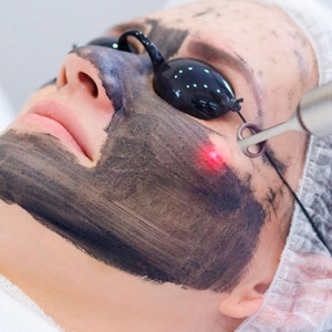 Despigmentante facial profundo  de manchas localizadas con Láser ND YAG