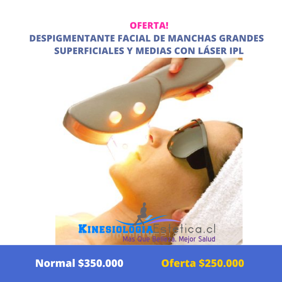 Despigmentante facial de manchas grandes superficiales y medias con