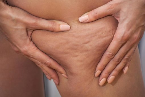 8 sesiones ondas de choque