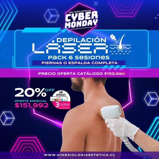 Depilación láser piernas o espalda completa
