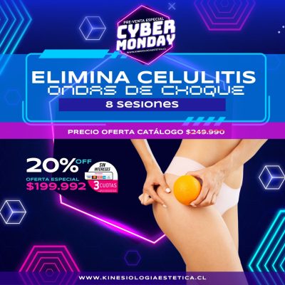 Celulitis con ondas de choque 8 ses.