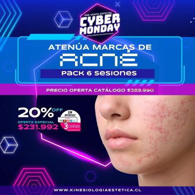 marcas de acné