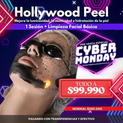 Hollywood Peel