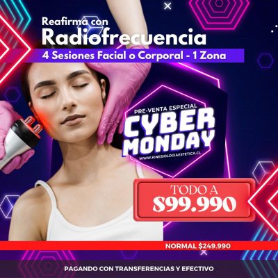 Radiofrecuencia facial o corporal 1 zona