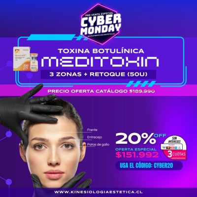 3 zonas de Botox Oferta Cyber Monday