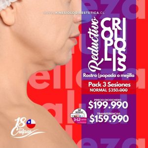 CRIOLIPÓLISIS PAPADA O MEJILLA 3 SES.