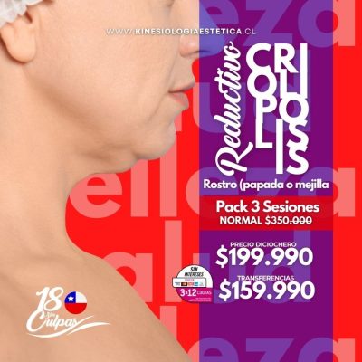 CRIOLIPÓLISIS PAPADA O MEJILLA 3 SES.