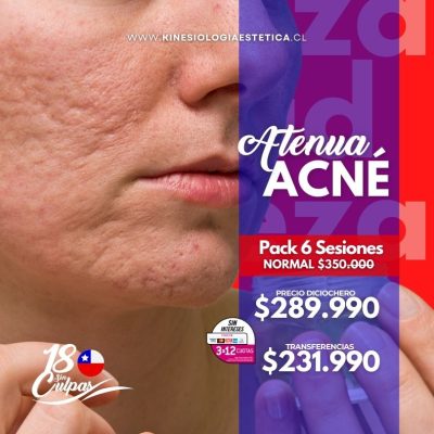 ATENUA ACNÉ PACK 6 SES.