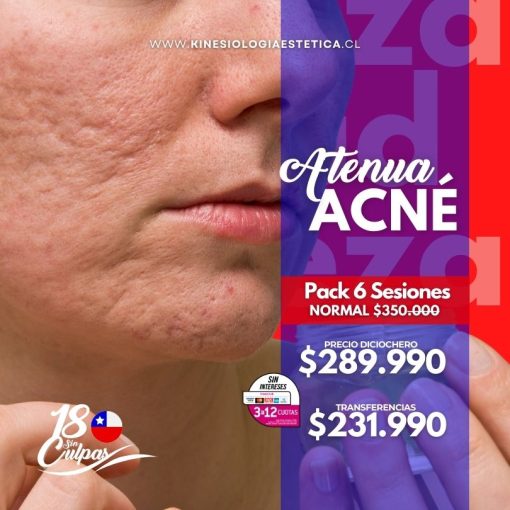 ATENUA ACNÉ PACK 6 SES.