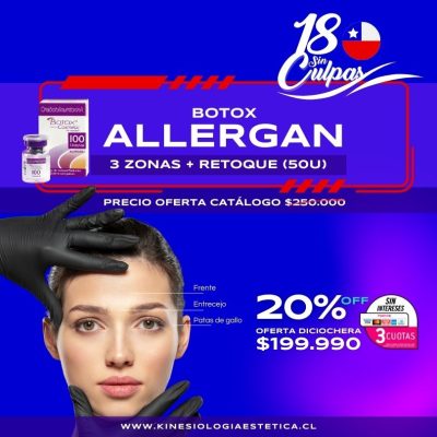 BOTOX 3 ZONAS + RETOQUE (50U)