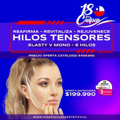 HILOS TENSORES