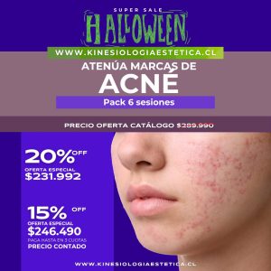 Atenúa Marcas de Acné
