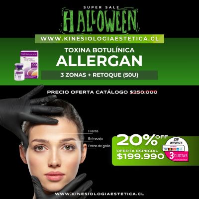 Toxina Botulínica Allegran 3 Zonas + Retoque (50U)