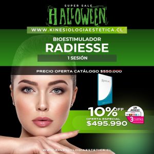 Radiesse Bioestimulador 1 ses.