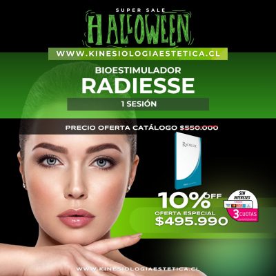 Radiesse Bioestimulador 1 ses.