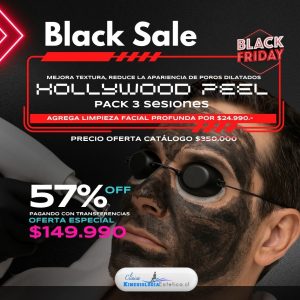 Hollywood Peel 3 ses.