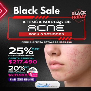 Atenúa Marcas de Acné 6 ses.