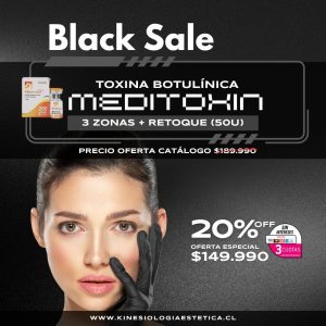 Meditoxin 3 Zonas + Retoque (50U)