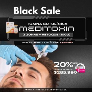 Meditoxin 3 Zonas + Retoque (100U)