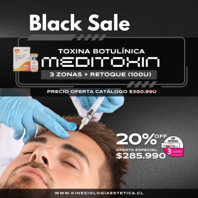 Meditoxin 3 Zonas + Retoque (100U)
