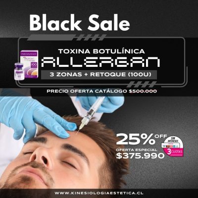 Botox 3 Zonas + Retoque (100U)