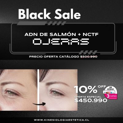 ADN de Salmón + NCTF Ojeras