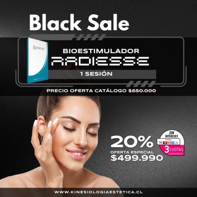 Bioestimulador Radiesse1 ses.