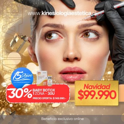 Baby Botox 1 Zona 30U